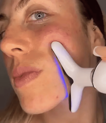 Masajeador Led Reductor de Arrugas y Papada BLANCO
